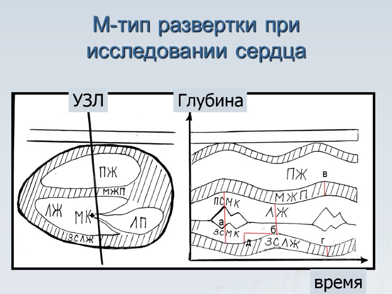 М-тип развертки при исследовании сердца Глубина время УЗЛ